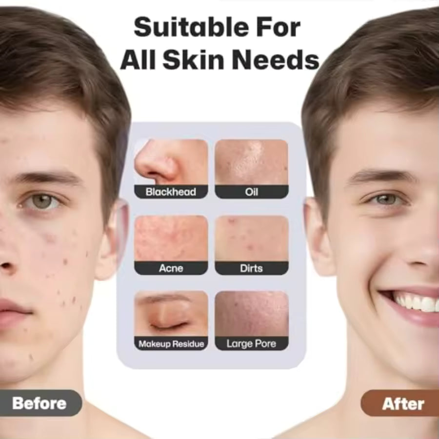 PRITECH Heatable Silicone Facial Cleansing Brush